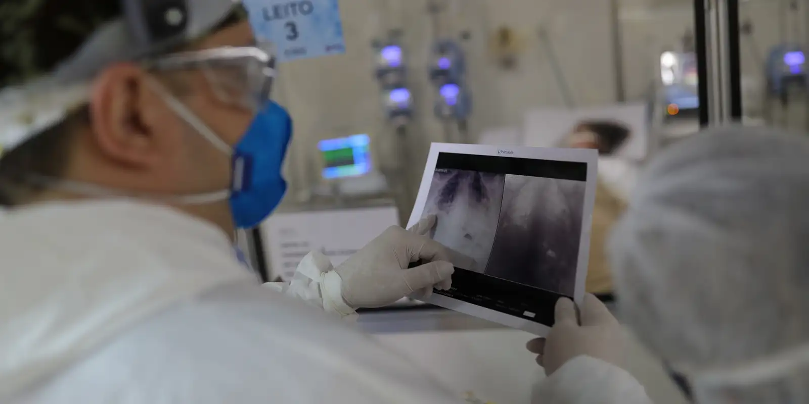 Covid é principal causa de internação por síndrome respiratória no Rio